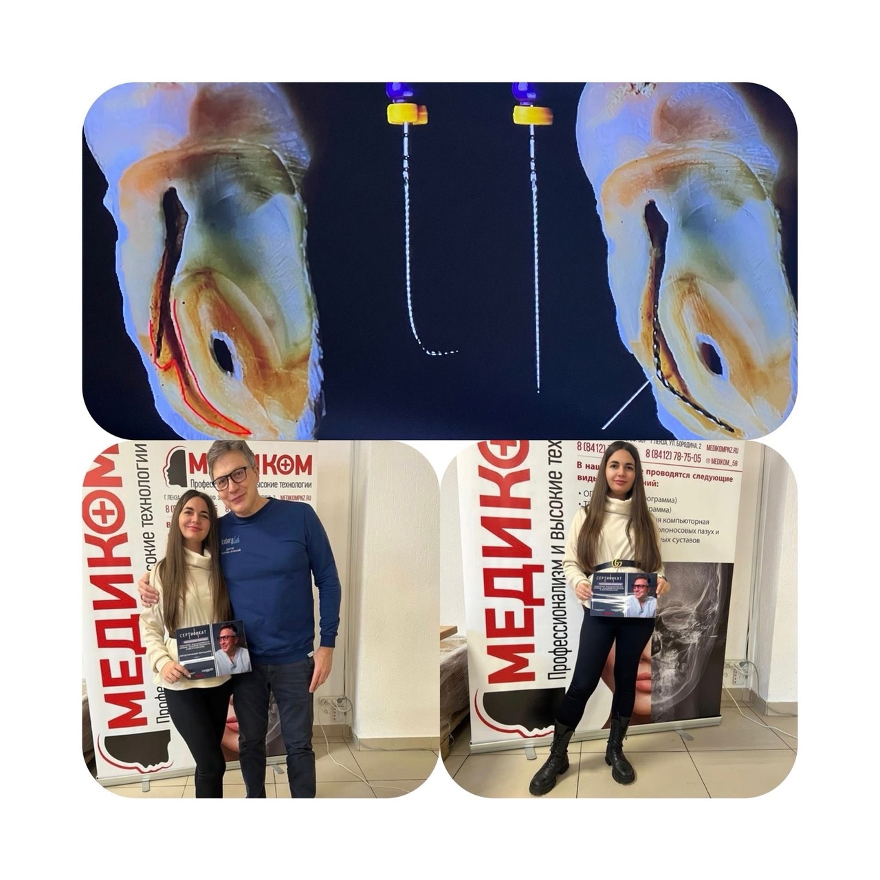 Курс Алексея Болячина Врач-стоматолог, кандидат медицинских наук. Член Российской эндодонтической ассоциации, Американской эндодонтической ассоциации, Европейской Ассоциации Дентальной Микроскопии.